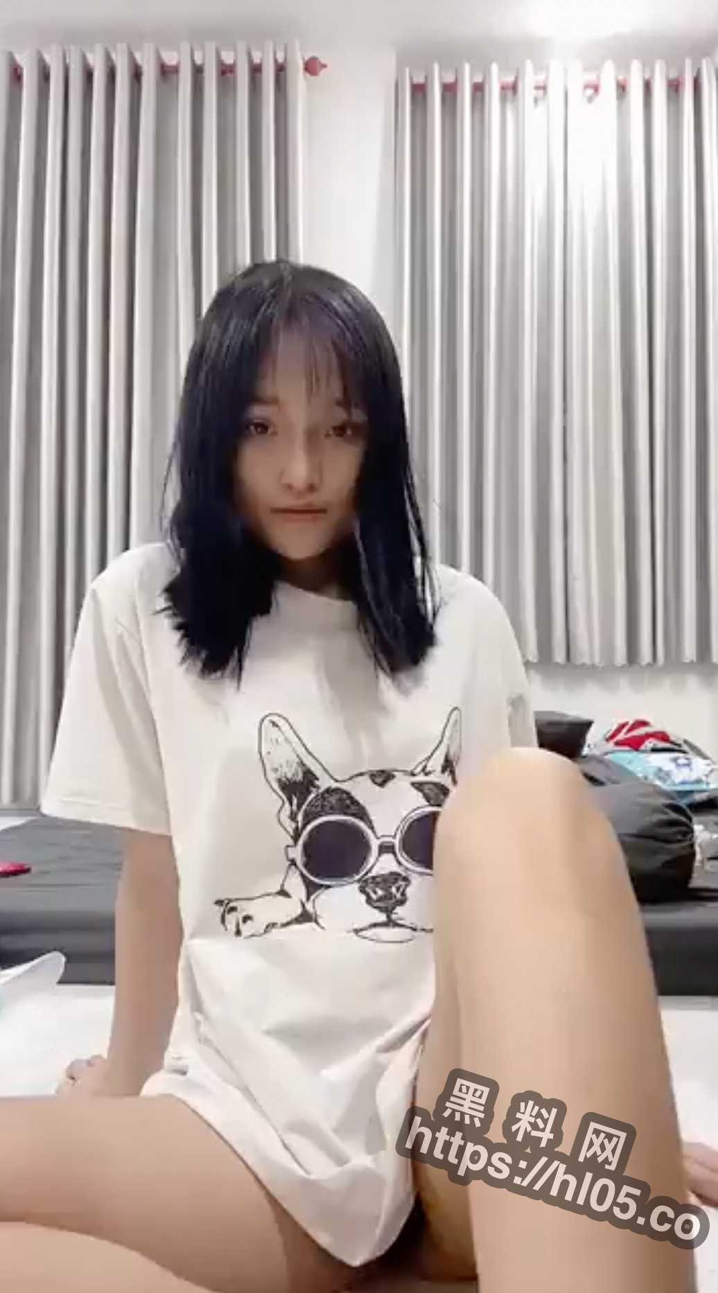1036X1866